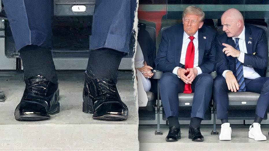 Врачи объясняют здоровье президента Трампа: причины отеков и синяков на фото Thumbnail